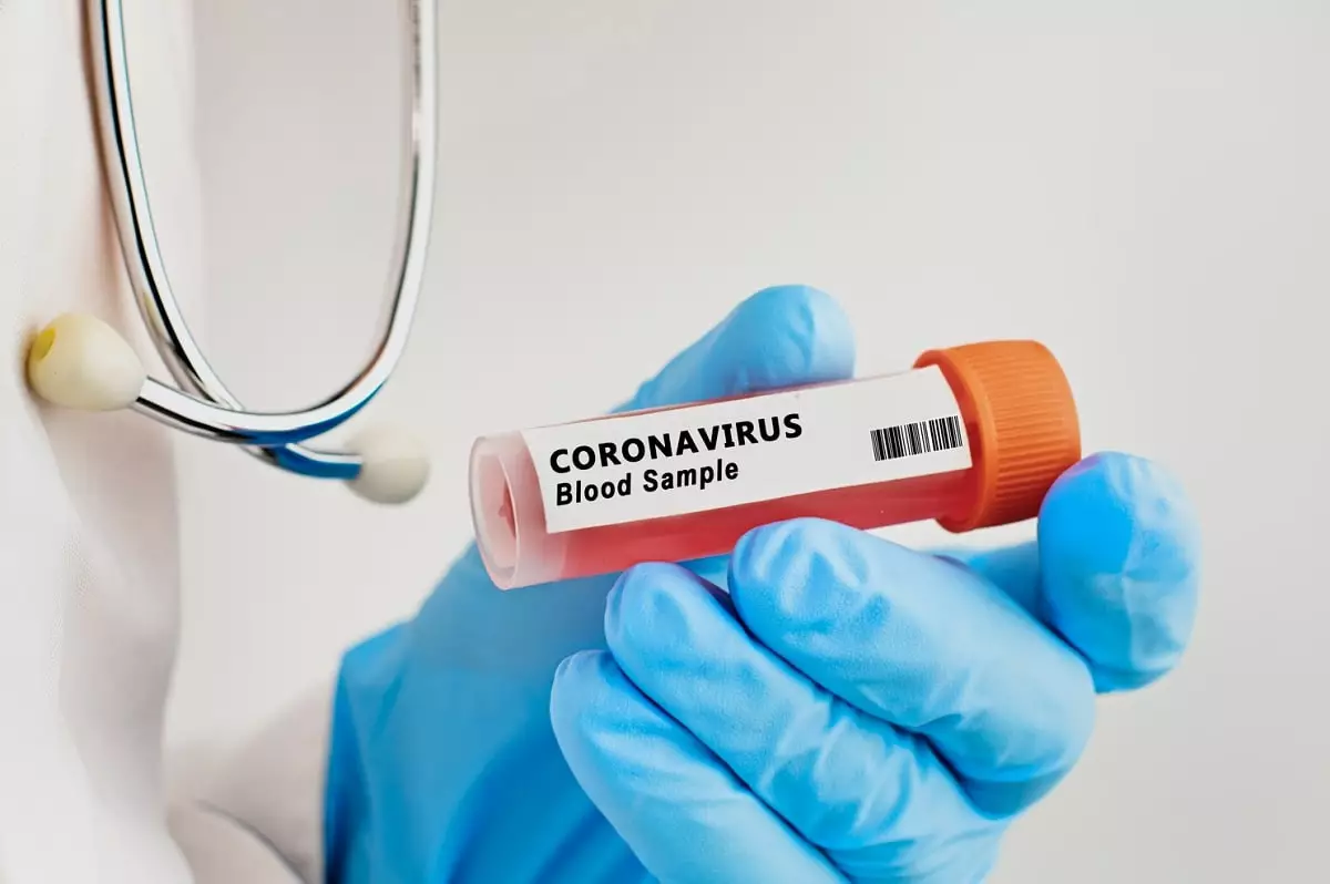 Напомнил о себе: коронавирусом заразились около 500 казахстанцев
