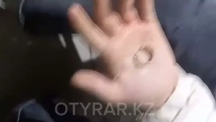 Снять кольцо с пальца девочки помогли спасатели в Шымкенте