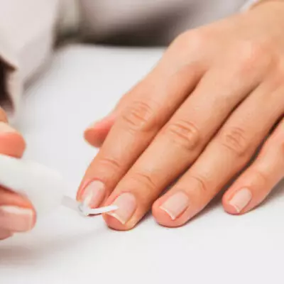 Советы дерматологов о том, как улучшить состояние ногтей