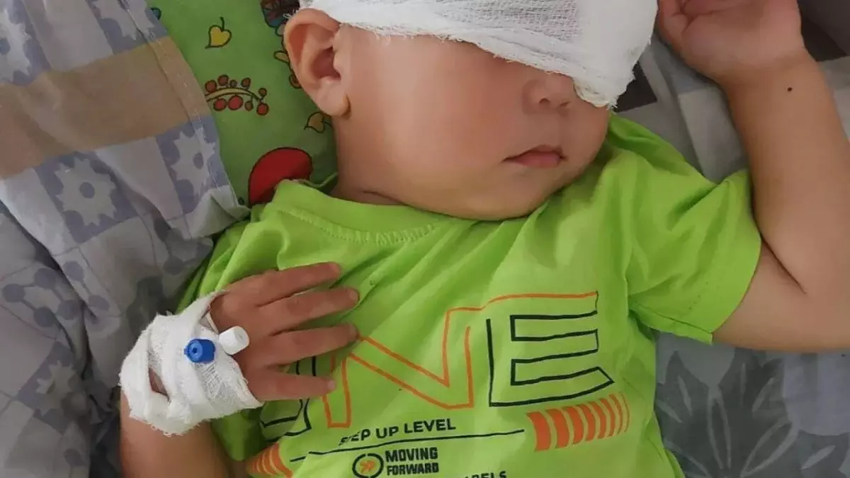 2-летний малыш едва не лишился глаза в детсаду Атырауской области