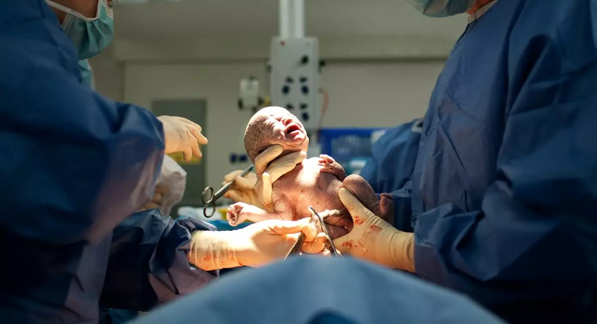 Ребенок с хвостом родился в Китае