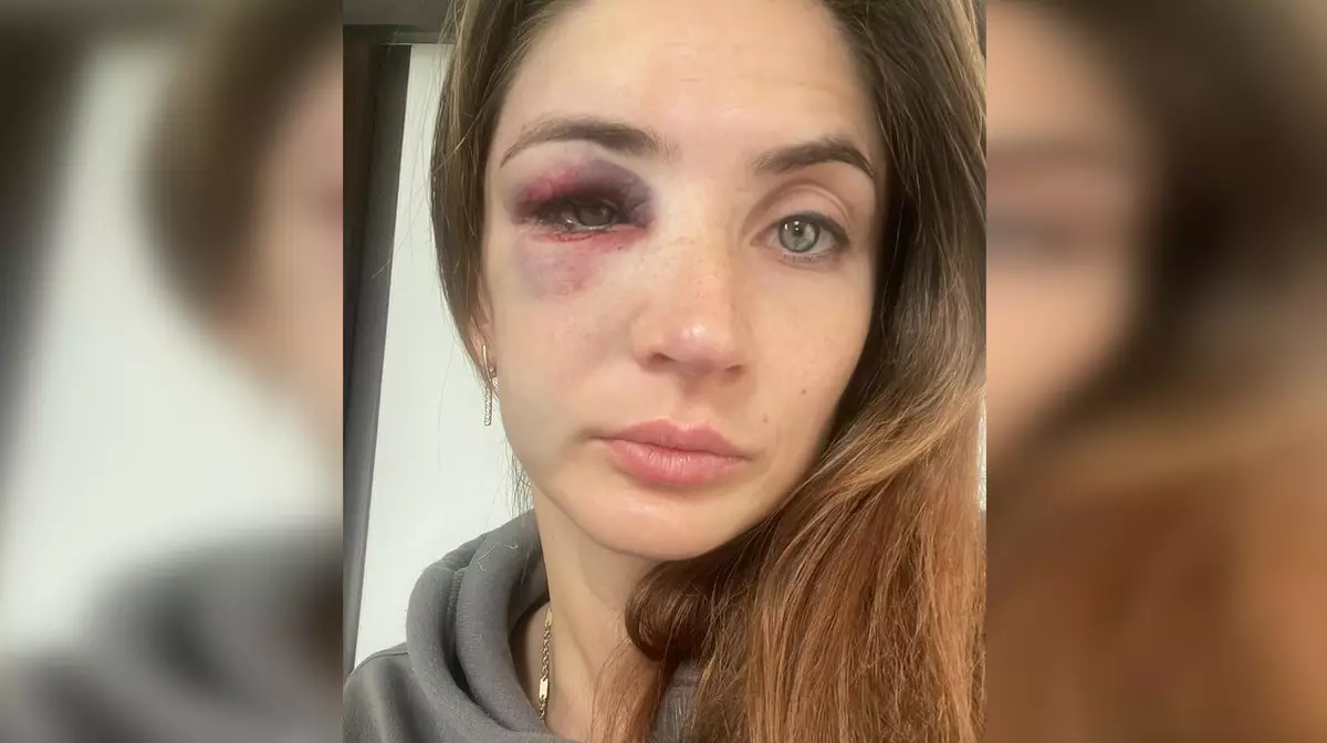 "Моя жизнь сейчас в опасности" — казахстанская волейболистка из России заявила о домашнем насилии