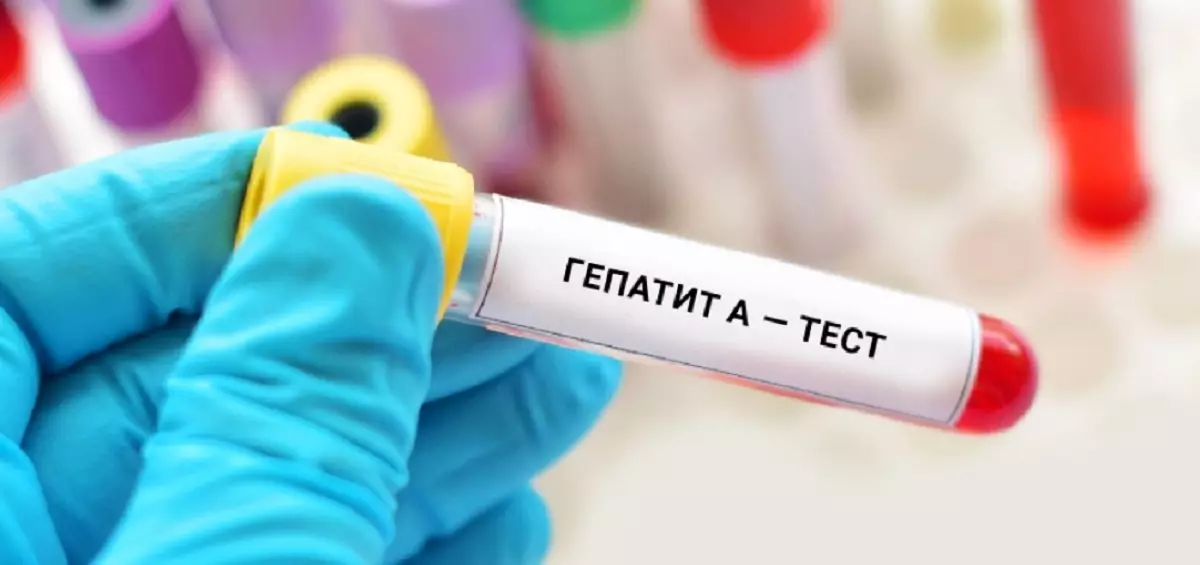 Заболеваемость гепатитом А растет в Казахстане
