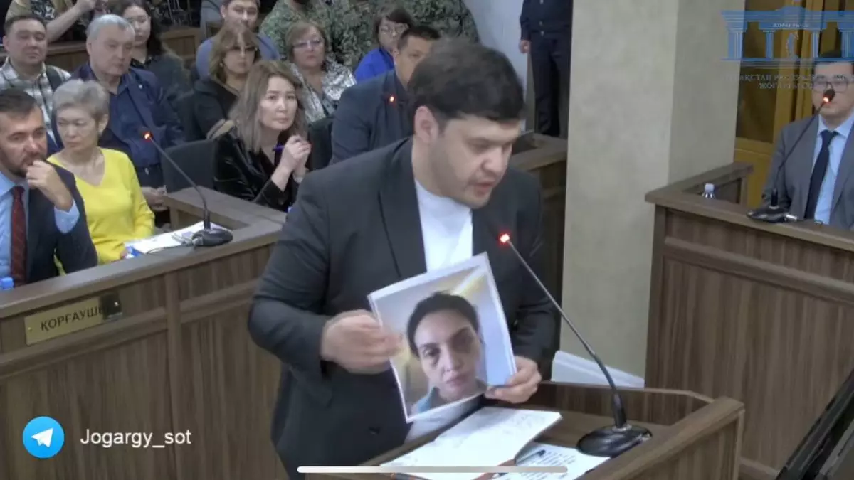Брат Салтанат Нукеновой показал её фото после избиений Бишимбаевым