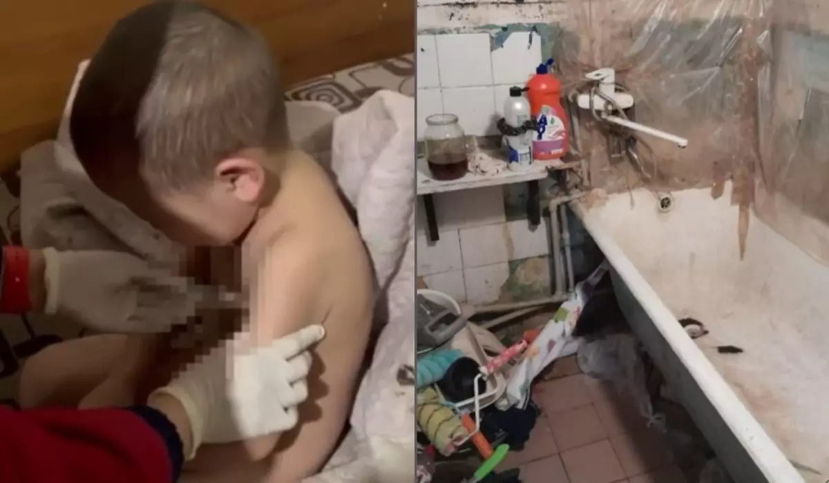 Измазанные фекалиями и побитые: жуткие условия проживания детей показала Закиева