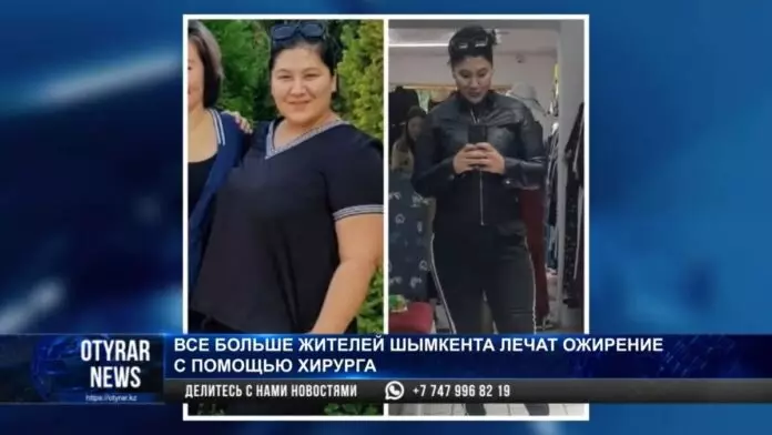 Все больше жителей Шымкента лечат ожирение с помощью хирурга