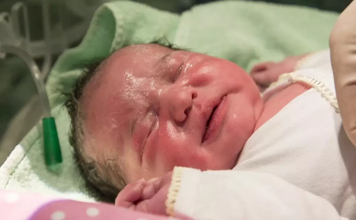 Новорожденного прооперировали в Шымкенте. Он не мог питаться молоком матери