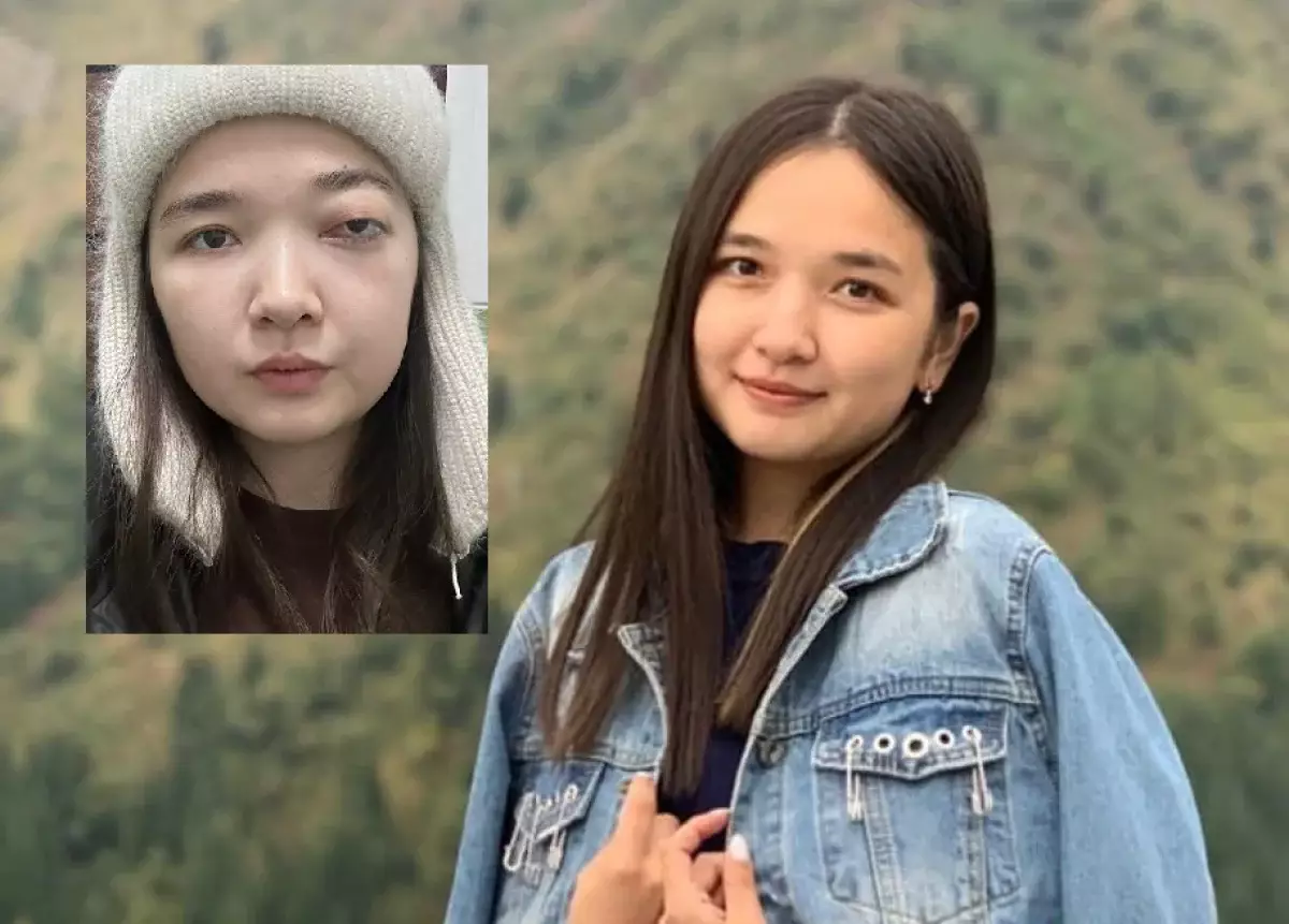 Рак пазухи носа не сразу выявили у 24-летней казахстанки. Ее лечили от синусита