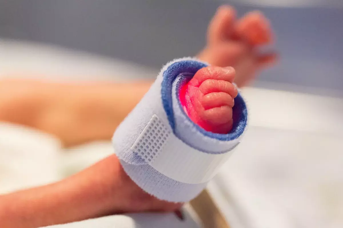 Новорожденного с «кишками наружу» спасли карагандинские врачи