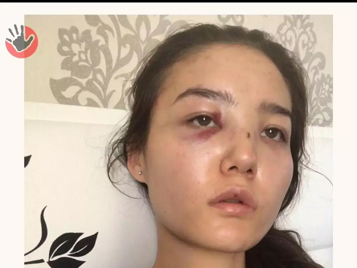 Жена советника посла РК в ОАЭ заявила о побоях и домашнем насилии