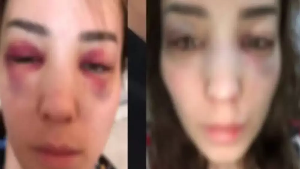 Казахстанка сравнила насилие в своей семье с делом Бишимбаева: в полиции сделали заявление
