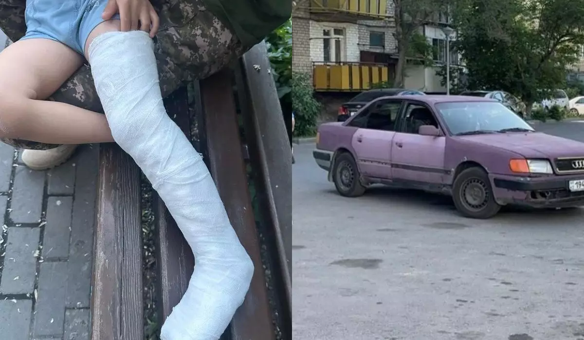 Перелом ноги в двух местах получил малыш после наезда авто в Талдыкоргане