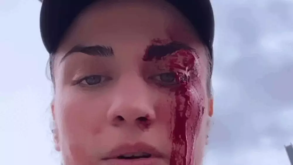 Нападение на боксершу Аминат Эльбукаеву: подробности инцидента в Швейцарии