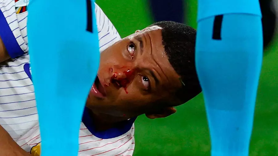 Мбаппе сломал нос и, похоже, пропустит весь групповой турнир Евро. У Франции проблемы?