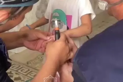 Спасатели сняло кольцо с пальца ребенка в Кызылорде