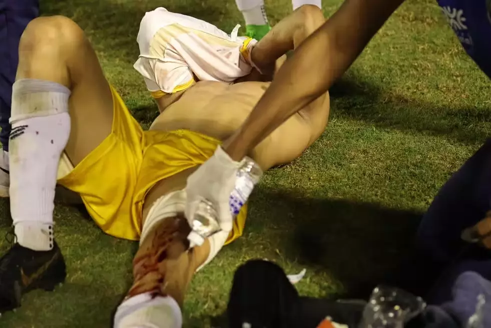 Полицейский выстрелил вратарю в ногу во время драки на матче в Бразилии