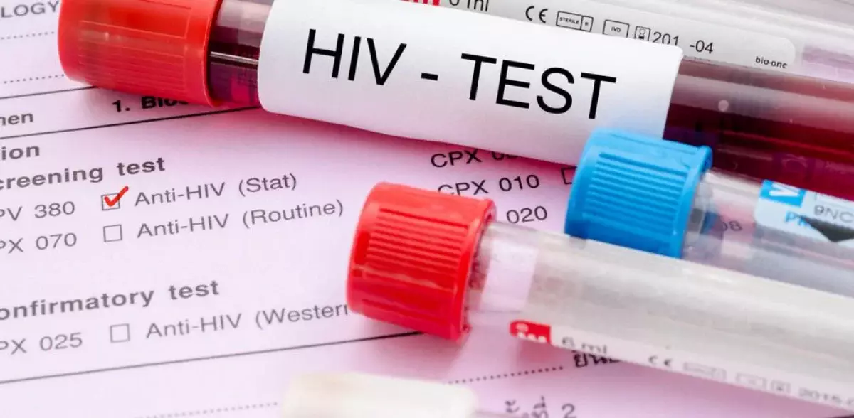 В Мангистау снизилась заболеваемость ВИЧ