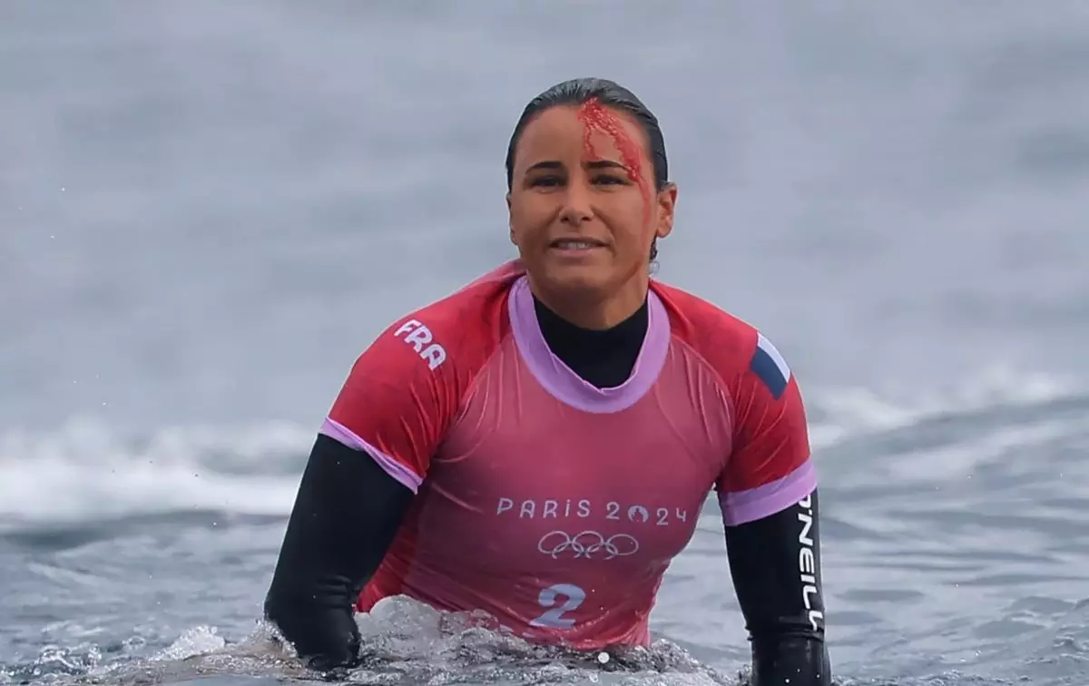 Французская серфингистка Дефей до крови рассекла голову на Олимпиаде