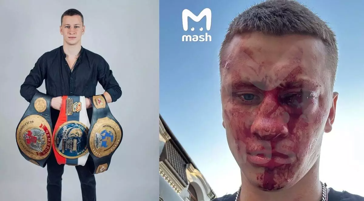 Чемпион Европы по боксу лишился глаза в массовой драке