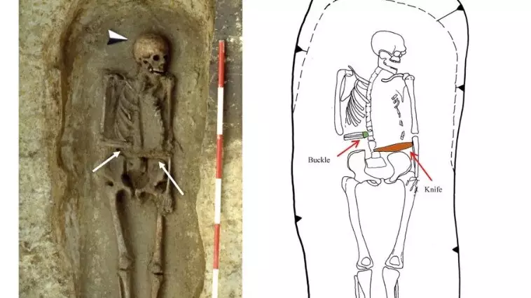 Древнейший скелет человека с протезом обнаружили археологи в Италии