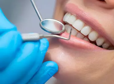 Более четверти всех расходов казахстанцев на медицину приходится на услуги стоматологов