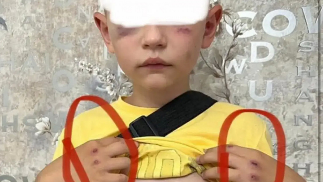 Анасы күйеуіне шаң жуытпай отыр. Өгей әкесі сегіз жастағы баланы аяусыз соққыға жыққан