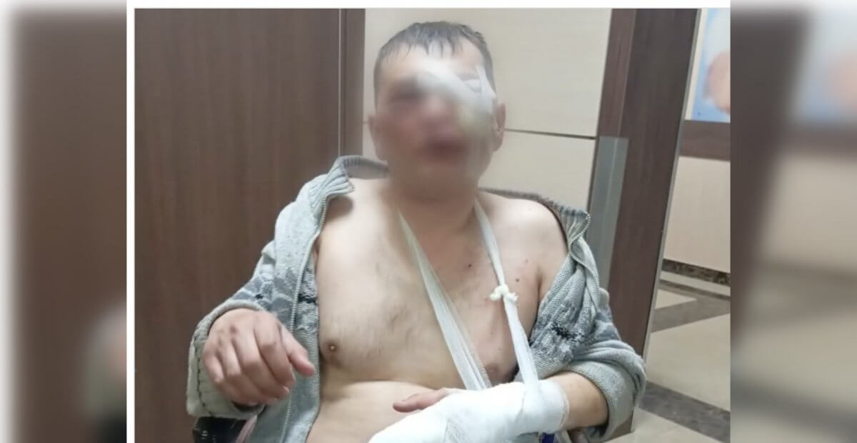 Бывшие коллеги жестоко избили лесника в Щучинске