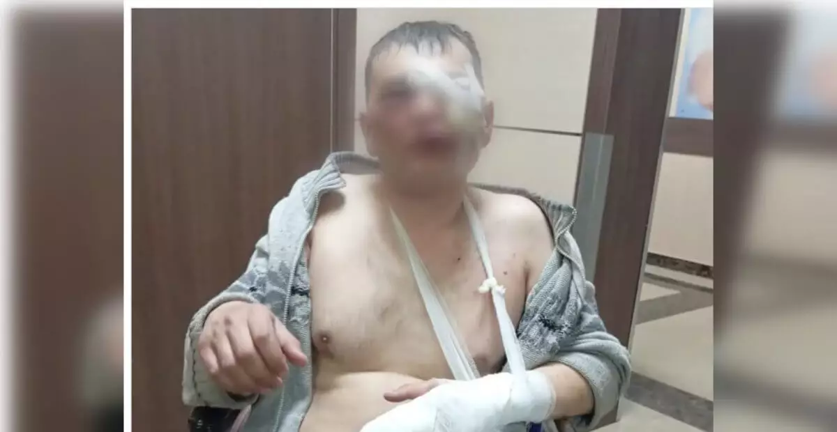 Бывшие коллеги жестоко избили лесника в Щучинске