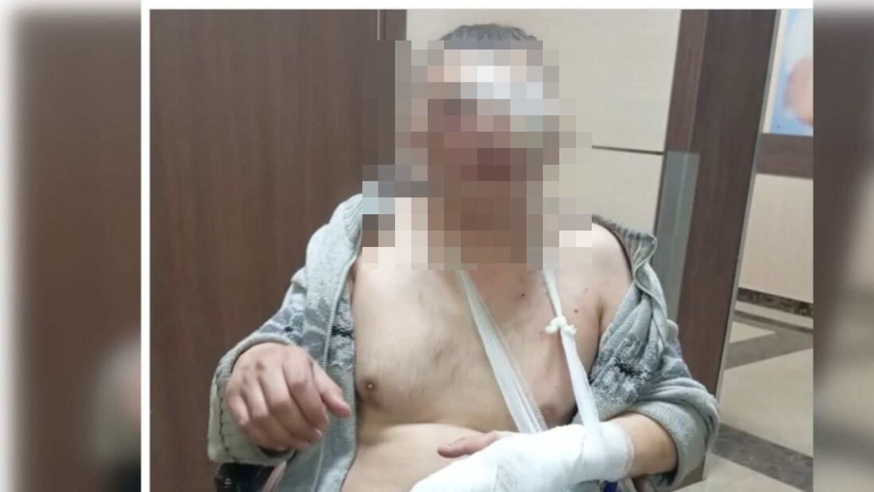 Саусағын сындырып, ернін тілген: Орманшыны аяусыз соққыға жыққандар кімдер?