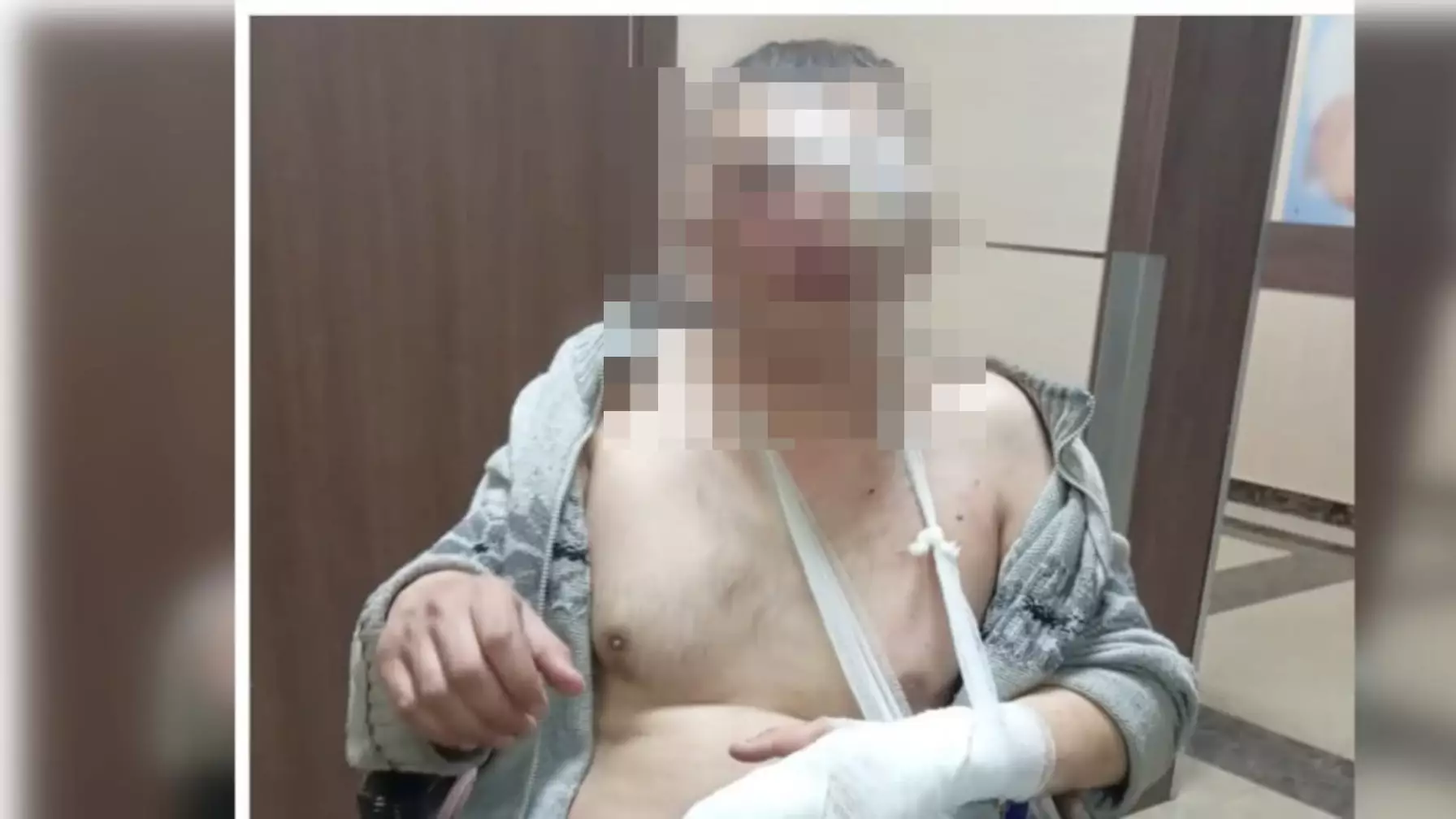 Саусағын сындырып, ернін тілген: Орманшыны аяусыз соққыға жыққандар кімдер?