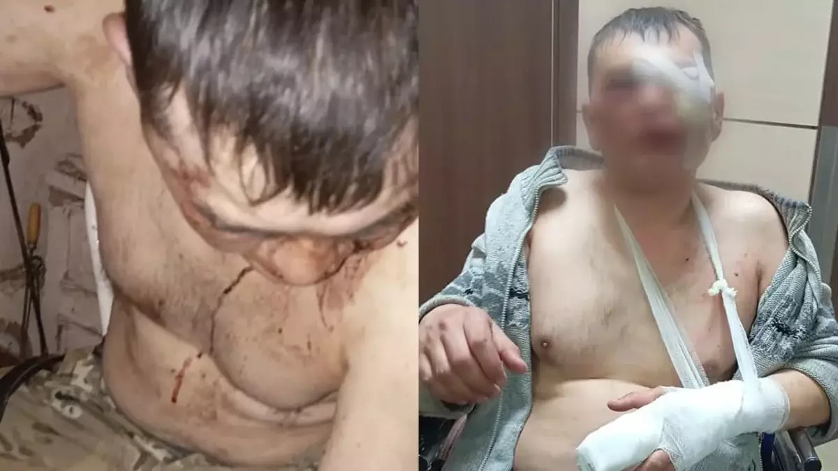 Лесника жестоко избили в Акмолинской области