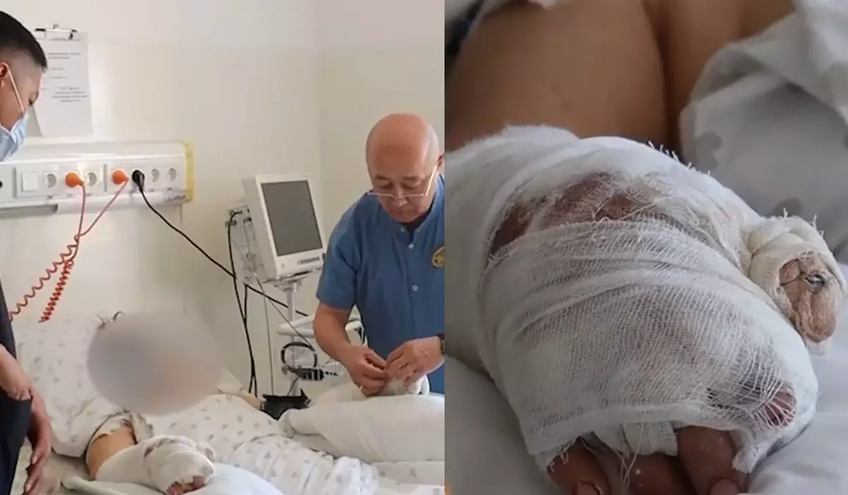 «Отрубил пальцы топором из ревности»: появились шокирующие подробности нападения учителя на жену в Шиели