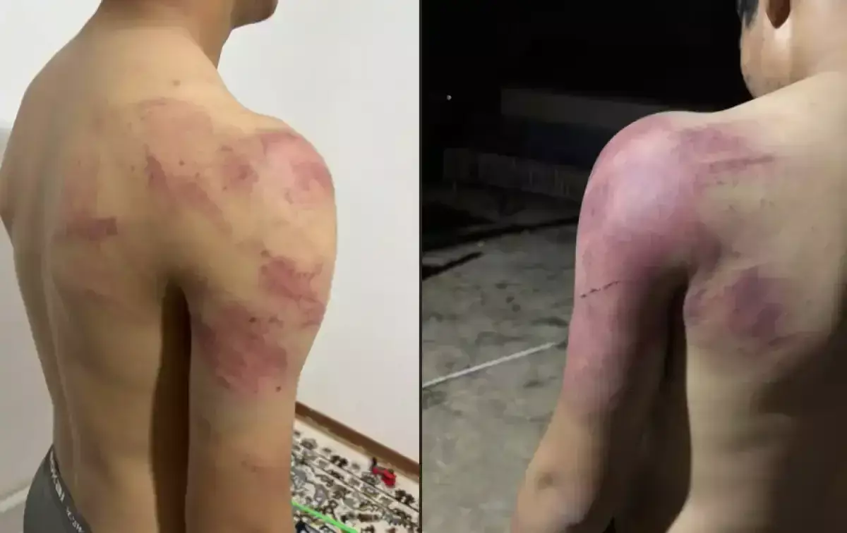 Атырауда жасөспірімді жабылып аяусыз соққыға жыққандар ұсталды