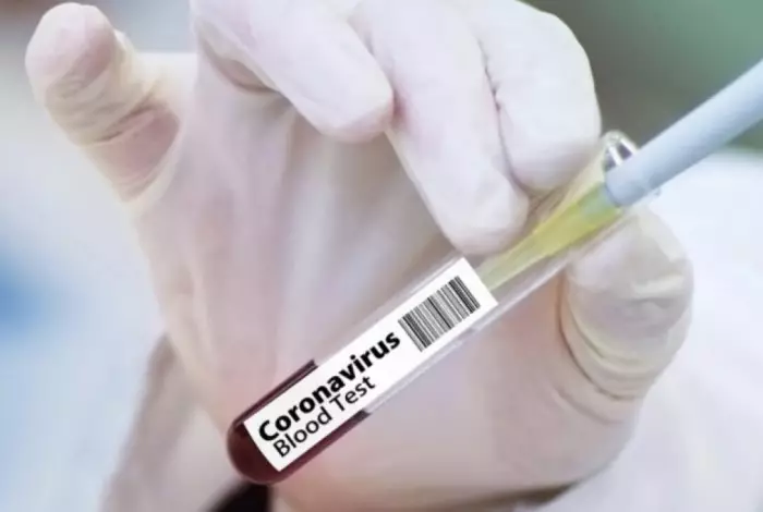 Минздрав прокомментировал ситуацию с COVID-19 в Казахстане