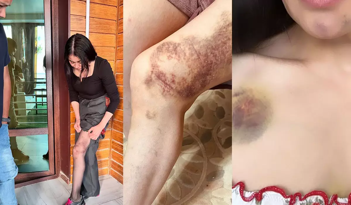 Ақтауда ер адам бұрынғы әйелін өлімші етіп сабап, 17-қабаттан лақтырып жіберетінін айтқан