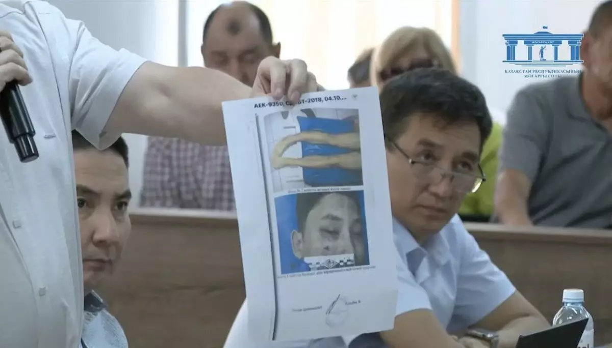Сотта Шерзат Полаттың дене жарақаттары көрсетілді