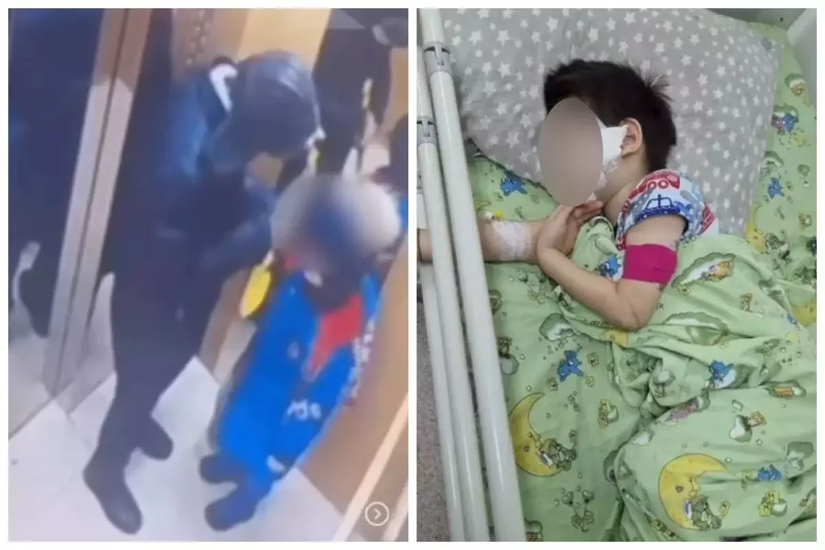 Астанада лифтте пышақ жарақатын алған 5 жасар баланың беті жансызданып қалды