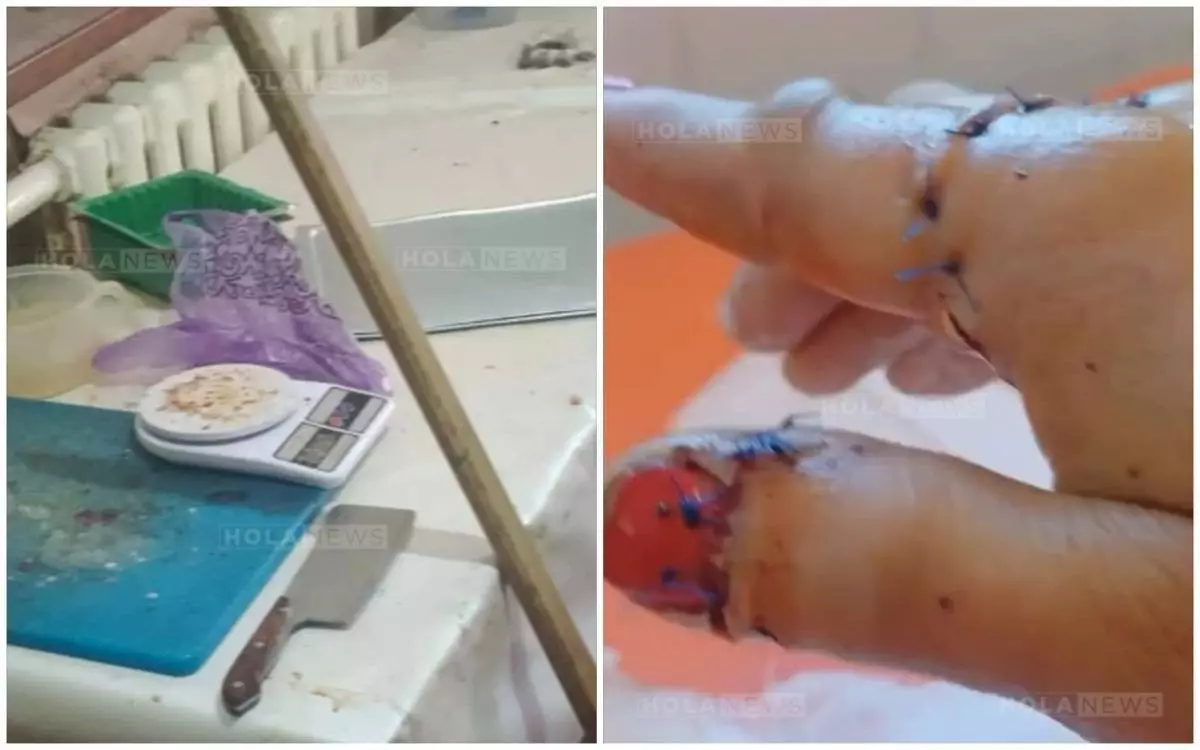 Қызылордада кәуапшы көпбалалы ананың саусақтарын балталап тастаған (ВИДЕО)