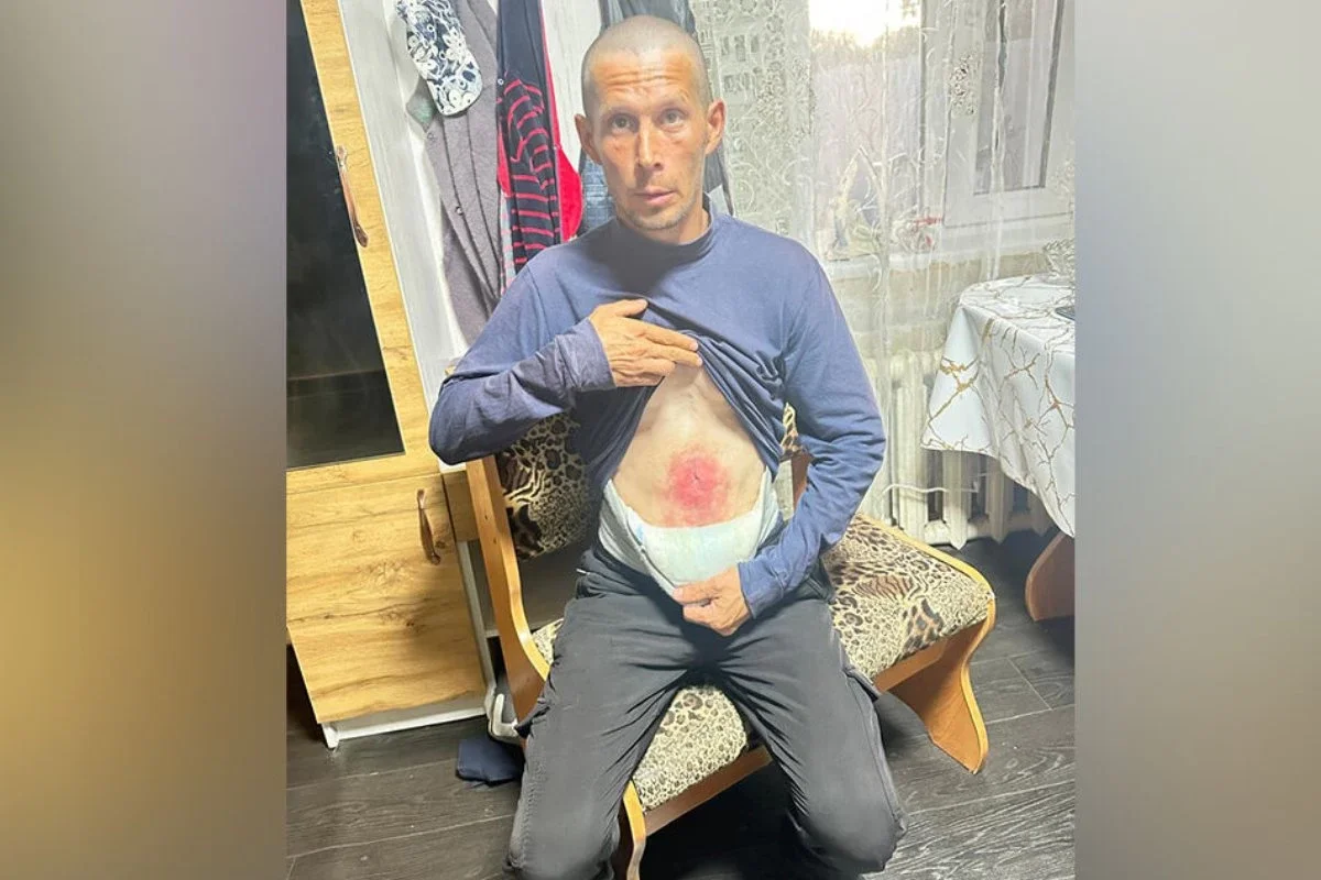 «Көмек көрсетпеді»: Қазақстандық ер адам жарасын тегін емдету үшін әдейі түрмеге түскен