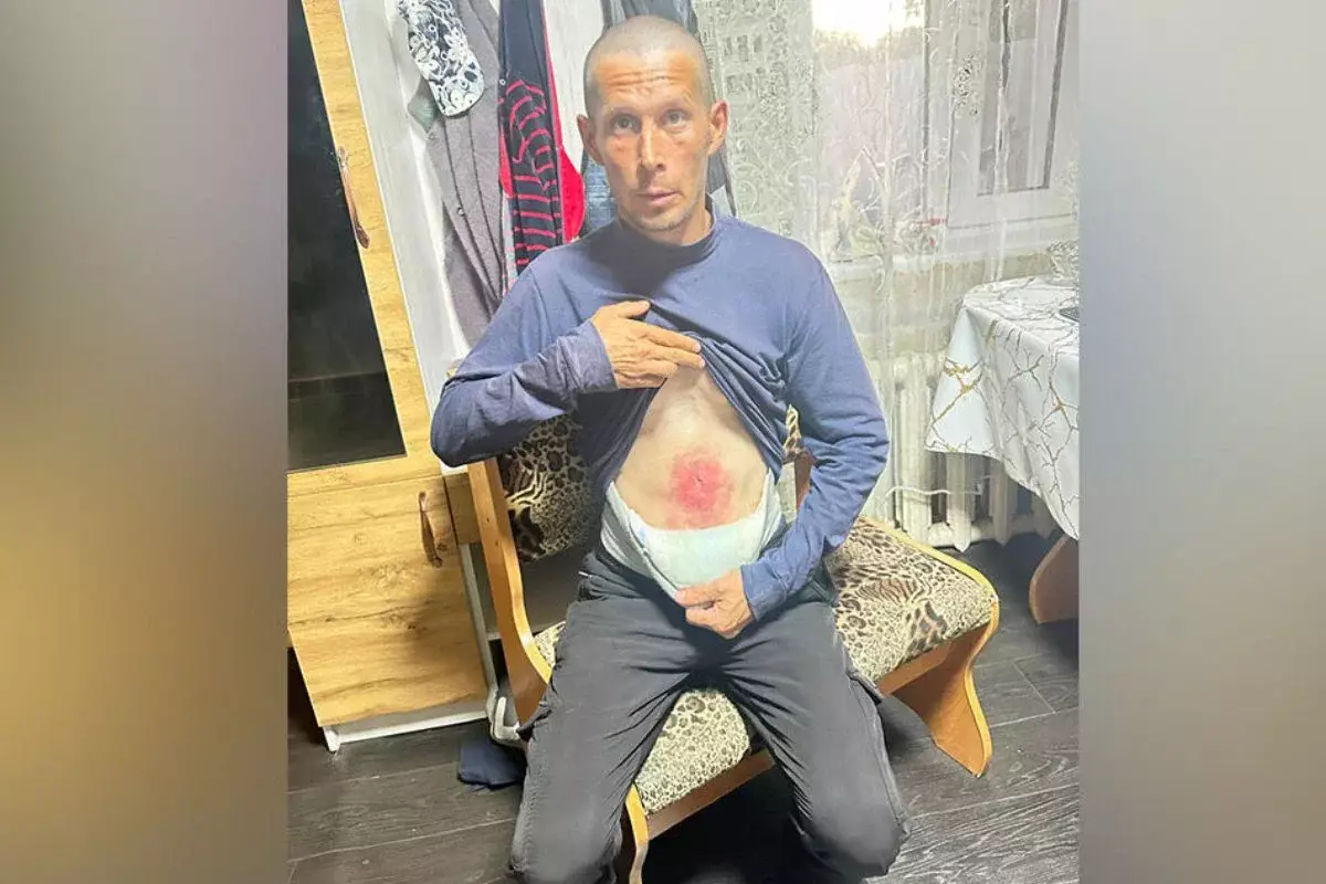 «Көмек көрсетпеді»: Қазақстандық ер адам жарасын тегін емдету үшін әдейі түрмеге түскен