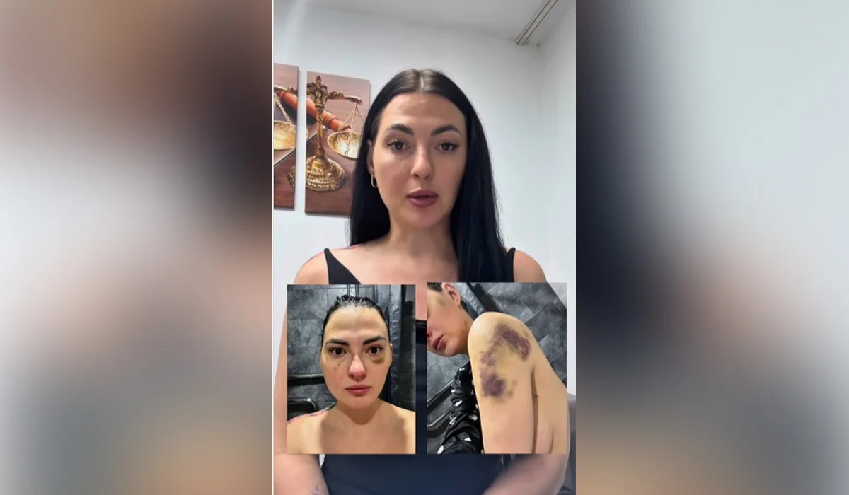 «Сот оны ақтап шықты»: күйеуінен оңбай таяқ жеген әйел әділдік іздеп, Тоқаевқа үндеу жасады (ВИДЕО)