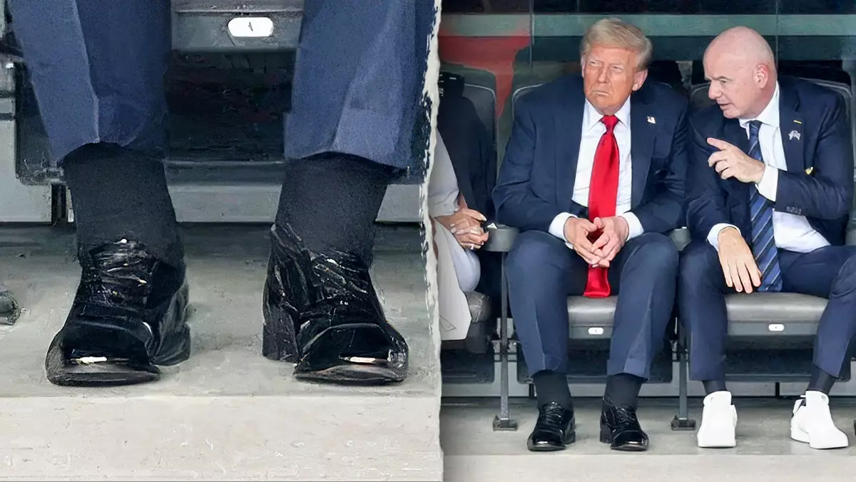 Врачи реагируют на предполагаемые проблемы со здоровьем Трампа после того, как фотографии показывают отеки и синяки.