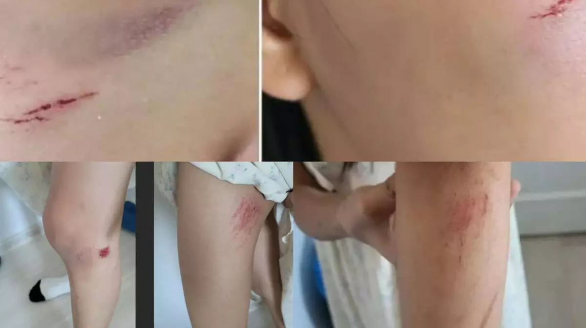 В Астане мужчина напал на двух маленьких сестёр