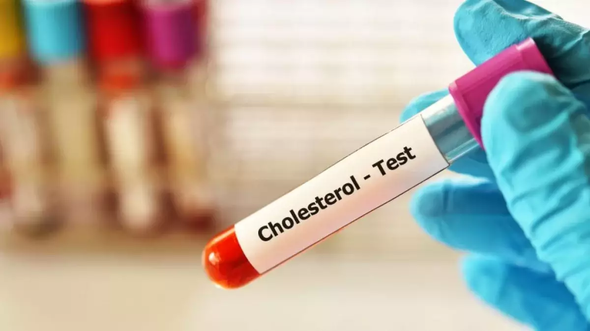 Врач объяснил, что искажает результаты анализа на холестерин