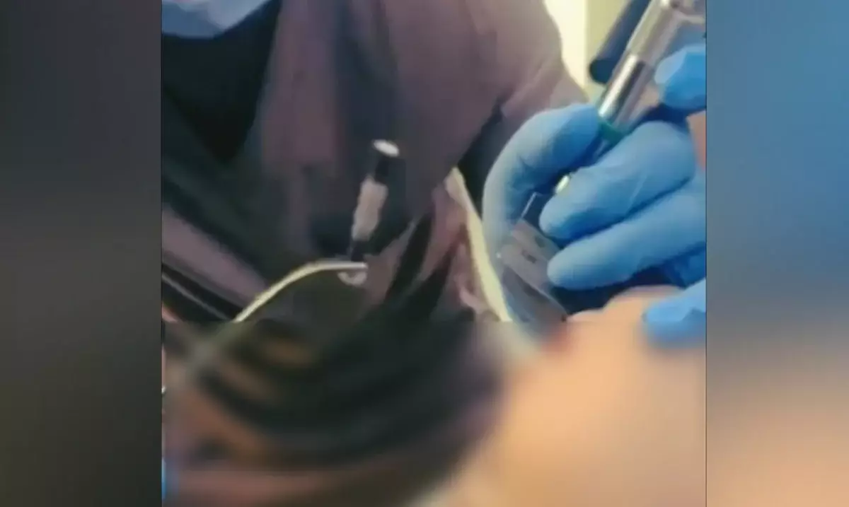 Шымкентте бір жасар бала 4 сантиметрлік шеге жұтып қойған