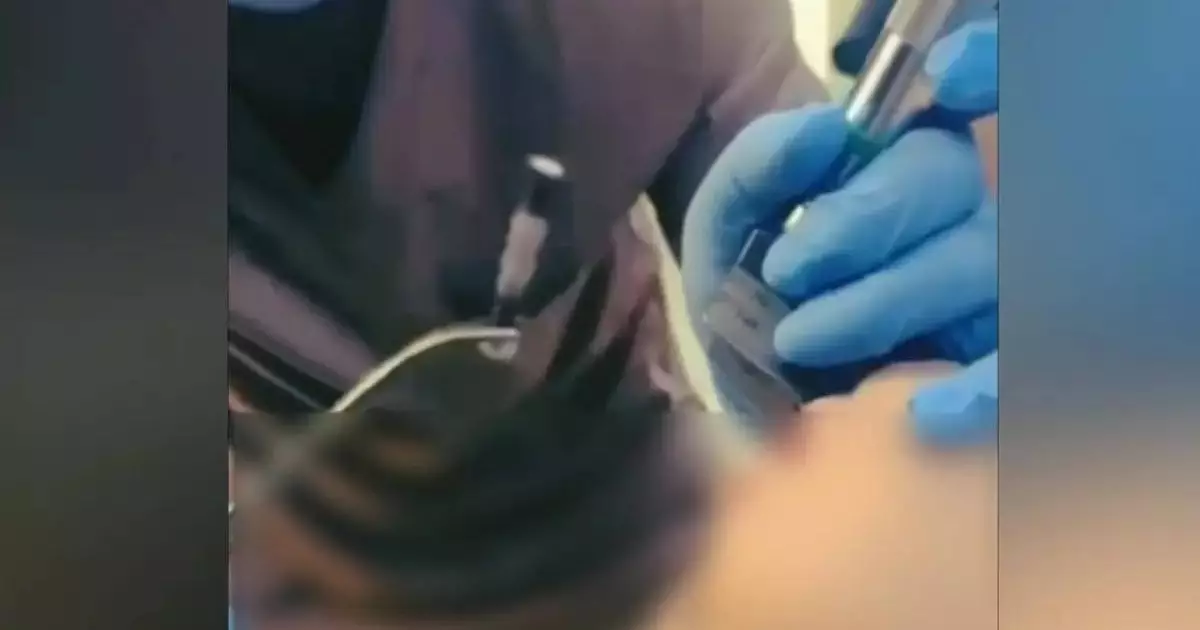  Шымкентте 1 жасар бала 4 сантиметрлік шеге жұтып қойған 