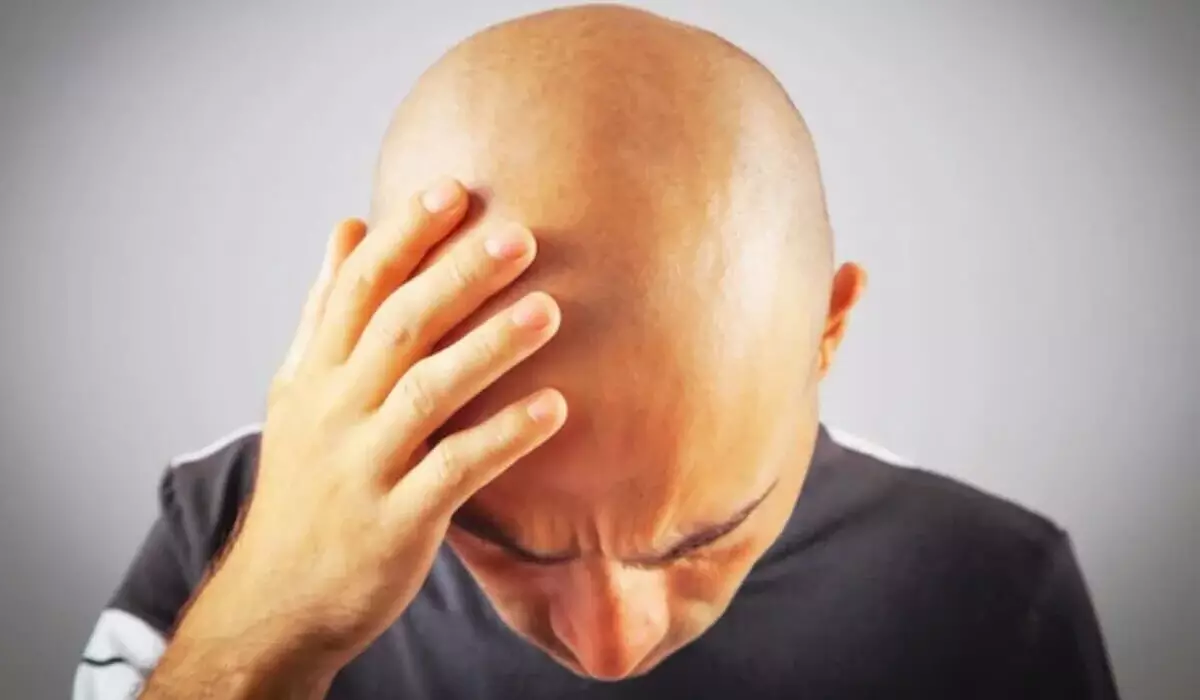 Ученые придумали, как вернуть волосы на лысине за 20 дней