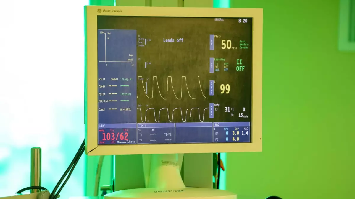 Қазақстанда жыл басынан бері 40 мың адам инсульт алған