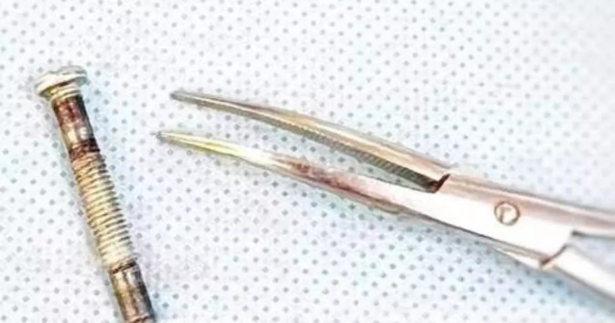  Түркістанда дәрігерлер көмейіне болт кіріп кеткен баланың өмірін сақтап қалды 