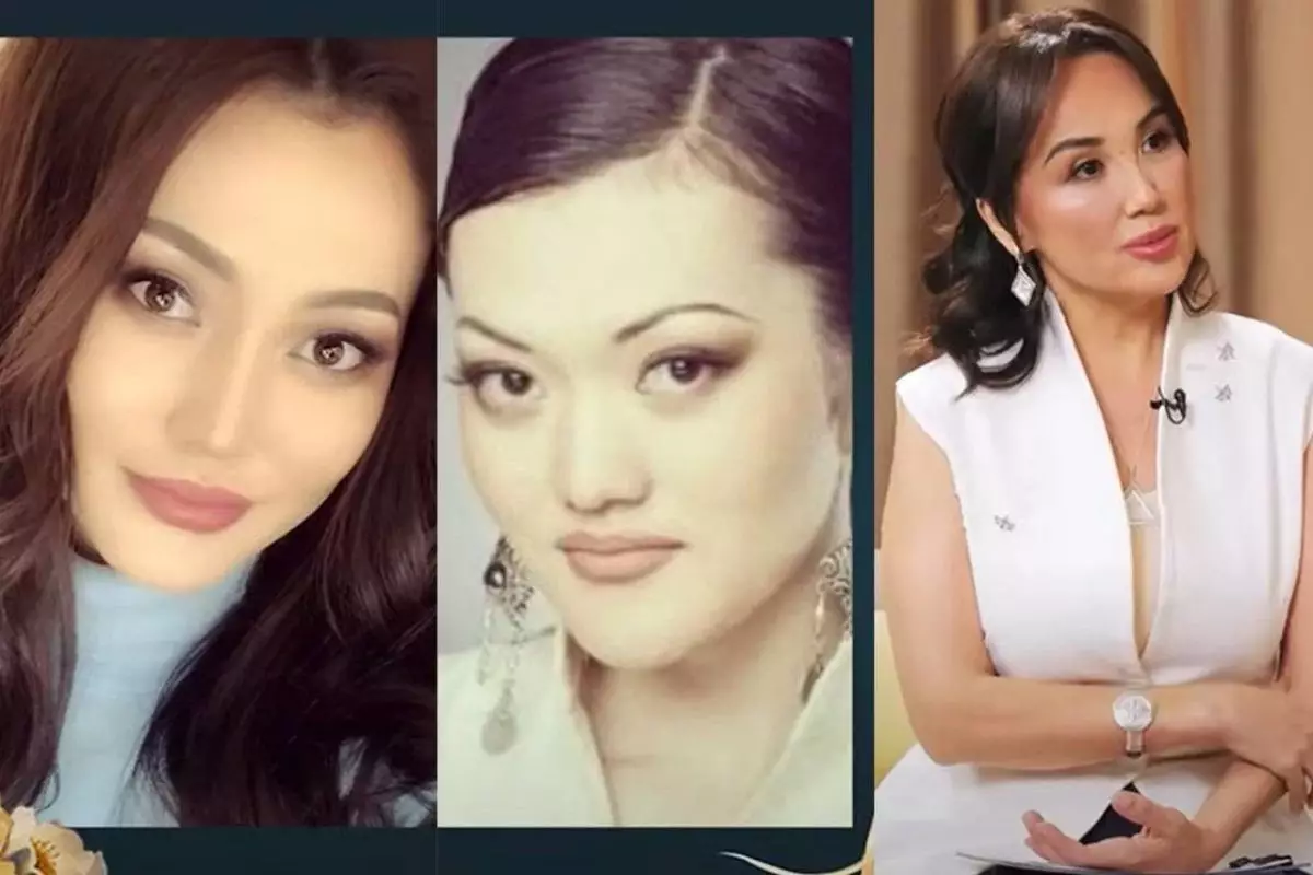 “Жақ сүйегін сындырған” - Ерке Есмахан пластикалық ота туралы айтты